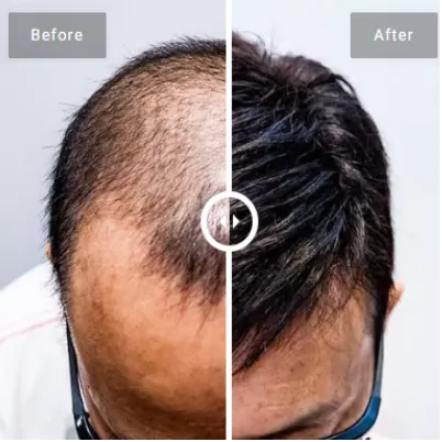 Image Natural-Looking Hair Solution 